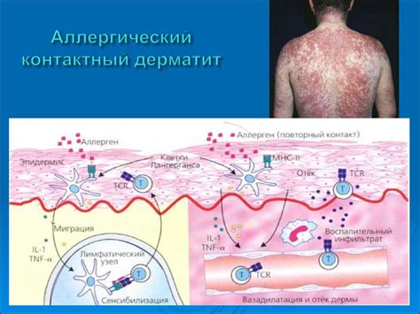 Аллергические реакции и дыхательные проблемы