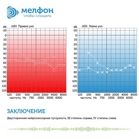 Анализ результатов аудиометрии