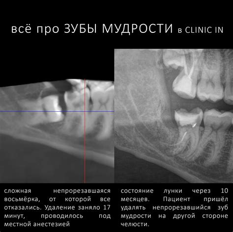 Безопасная и простая процедура