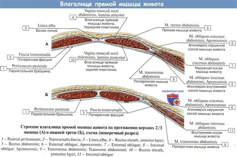 Белая линия живота