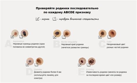 Биопсия родинок для выявления опасных изменений