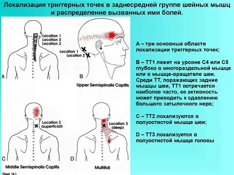 Болевые ощущения в области шеи и спины