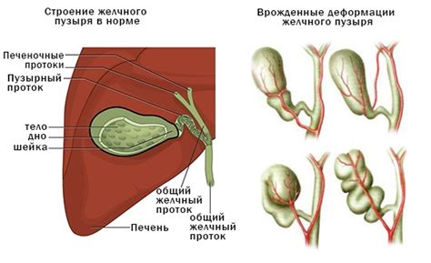 Боли в области желчного пузыря