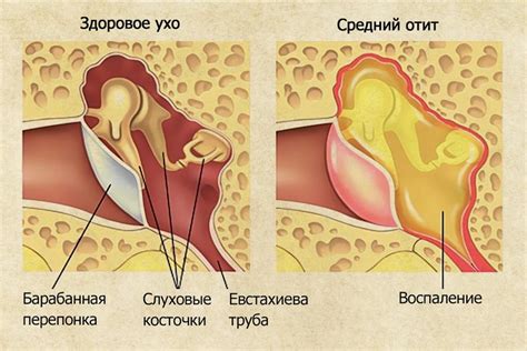 Боль в ухе