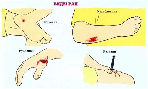 Боль и кровотечение