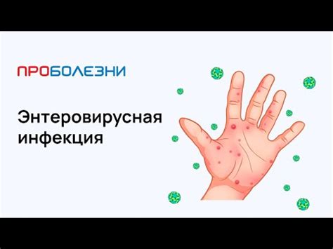 Бордетелла пертуссис IgG положительный: основные причины