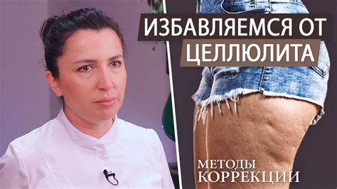 Борьба с целлюлитом: эффективные методы