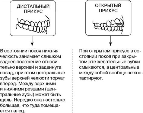 Важность правильного положения рук при приеме пищи палочками