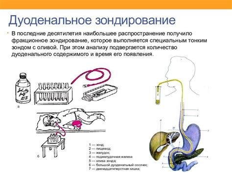 Важные вещи для дуоденального зондирования