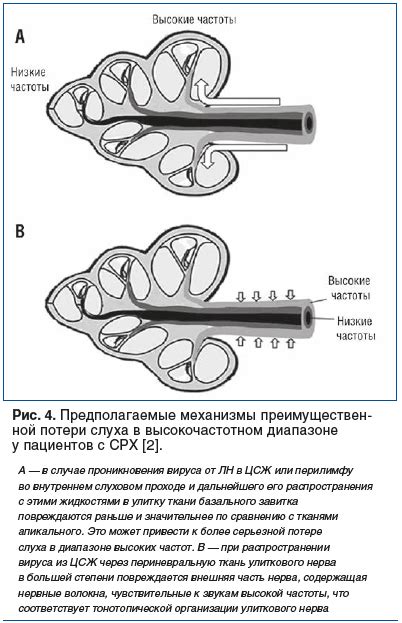 Вестибулярные нарушения и проблемы с равновесием