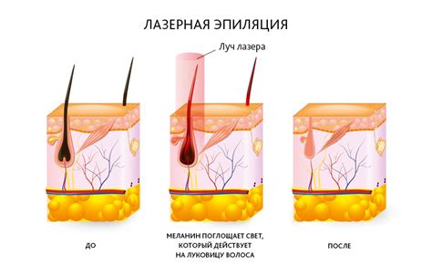 Виды мониторинга и их отличия