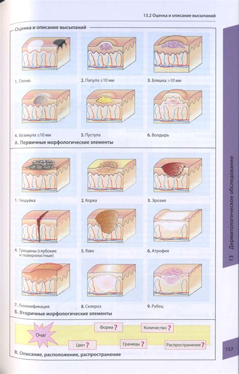 Виды сыпи на коже