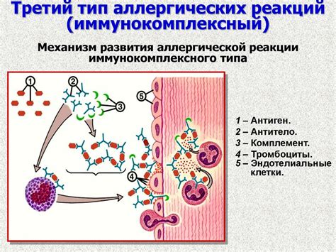 Влияние аллергических реакций на ларингоспазм