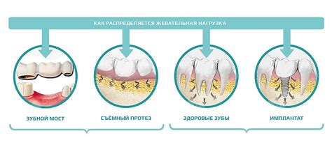 Влияние на зубы и костную ткань