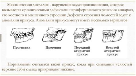 Влияние неправильного выключения на долговечность наушников