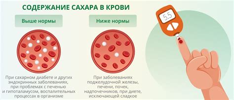 Влияние психоэмоционального состояния на сахар крови