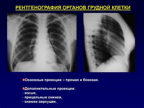 Влияние синусов на состояние легких