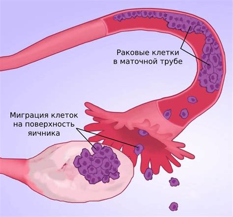 Влияние удаления маточной трубы на работу яичника