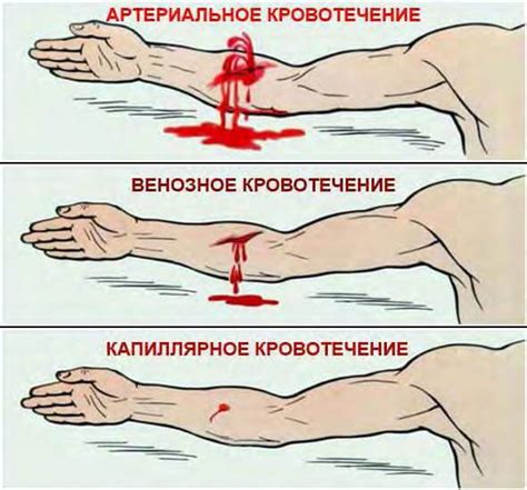 Внутренние повреждения и кровотечения