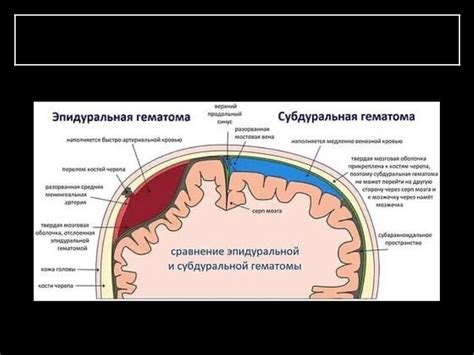 Внутричерепные признаки