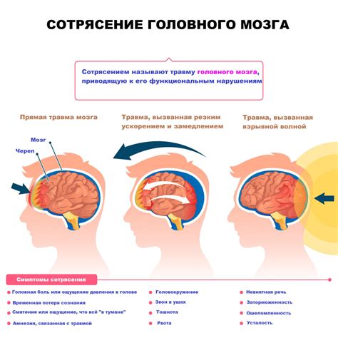 Воздействие сонного состояния на сотрясение мозга