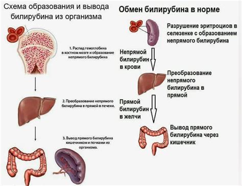 Возможные последствия непрямого понижения билирубина у ребенка