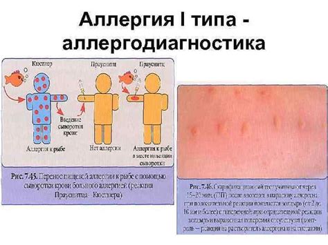 Возникновение аллергических реакций