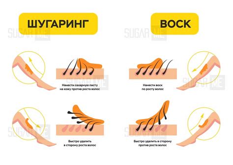 Воск или шугаринг: что лучше для глубокой депиляции?