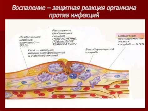 Воспаление как защитная реакция