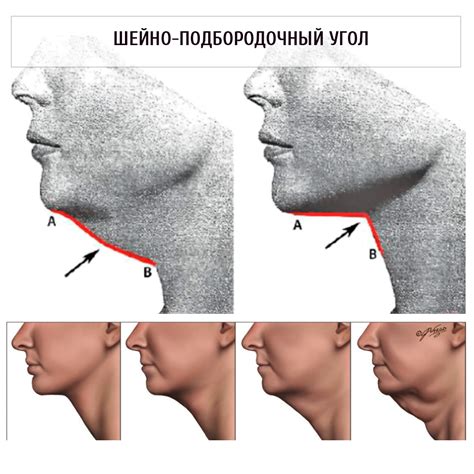 Второй подбородок и мужская привлекательность