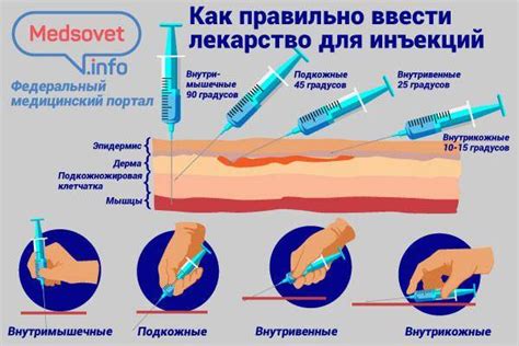 Выбор места для инъекций Румалона: важные рекомендации