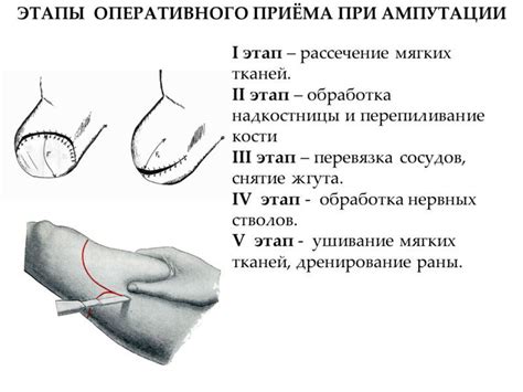 Выбор способа удаления неба