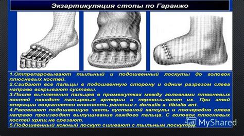 Гарпун как средство спасения