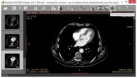 Главные особенности Radiant DICOM Viewer 64 bit