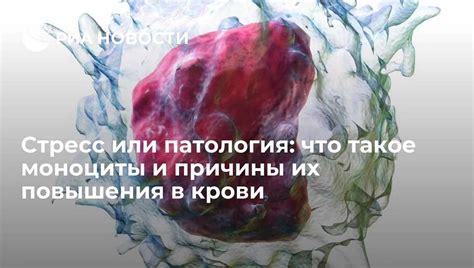 Главные причины повышенных моноцитов