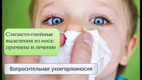 Гнойные выделения из носа у детей: что нужно знать родителям