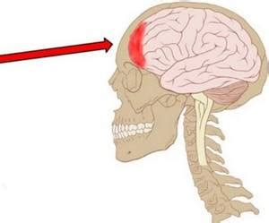 Головные травмы