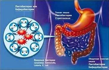 Гормональные изменения и нарушение микрофлоры