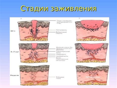 Гормональный фон и заживление ран