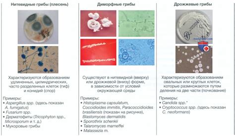 Грибковые инфекции или пигментные нарушения