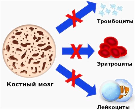 Дефекты кроветворения