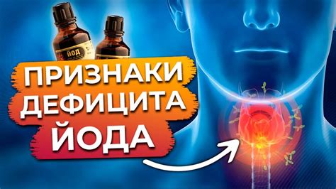 Дефицит йода и последствия