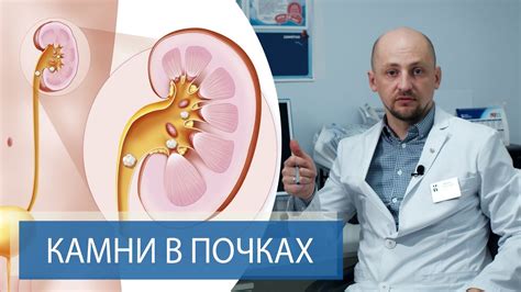 Диагностика гиперденсивных включений в почках