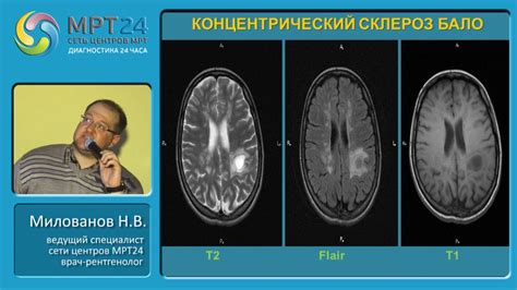 Диагностика гипотрофических изменений головного мозга