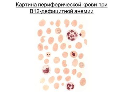 Диагностика дефицита витамина В12 у детей и беременных