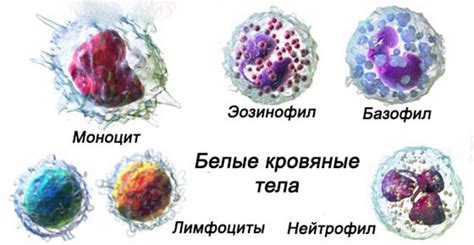 Диагностика и лечение White blood cells в моче