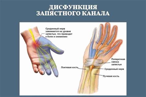 Диагностика и причины защемления нерва в тазу