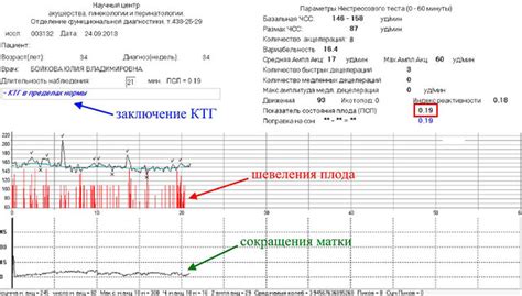 Диагностика низких эпизодов на КТГ