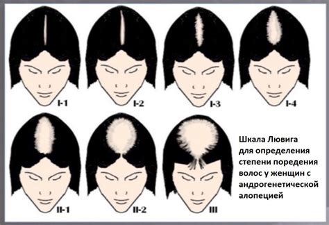 Диагностика облысения: определение причин и факторов риска