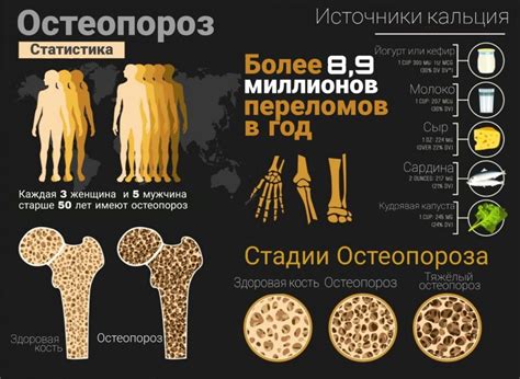 Диагностика остеопороза: современные методы исследования